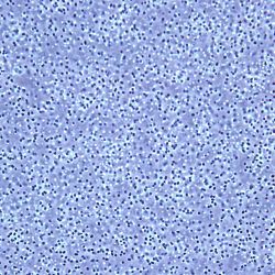 Klebsiella oxytoca Pau Klebsiella oxytoca Pau