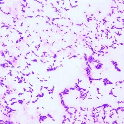 Janthinobacterium lividum Janthinobacterium lividum