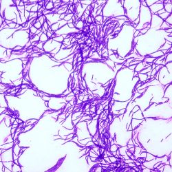 Janthinobacterium lividum Janthinobacterium lividum