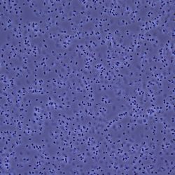 Acinetobacter baylyi Acinetobacter baylyi