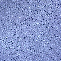 Acinetobacter baumanii 51 Acinetobacter baumanii 51