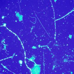 Bacteria from river water Bacteria from river water