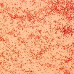 Sphingomonas xenophaga 2D23 Sphingomonas xenophaga 2D23