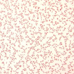 Acinetobacter sp. Acinetobacter sp.