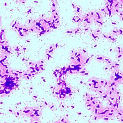 Pseudomonas fluorescens Pseudomonas fluorescens