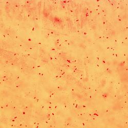 Limnobacter sp. CR2A4 Limnobacter sp. CR2A4