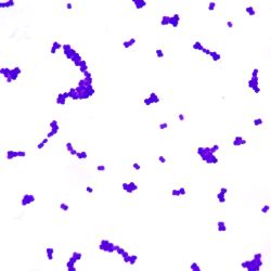 Deinococcus radiodurans Deinococcus radiodurans