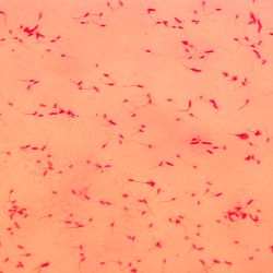 Erwinia carotovora Erwinia carotovora