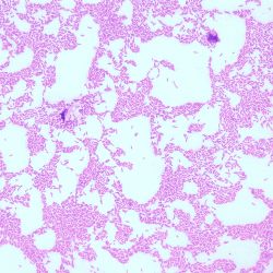 Janthinobacterium lividum Janthinobacterium lividum