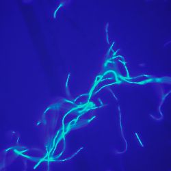 Janthinobacterium lividum Janthinobacterium lividum