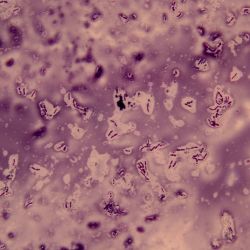 Bacillus licheniformis Labp Bacillus licheniformis Labp