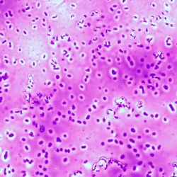 Pseudomonas fluorescens Pseudomonas fluorescens