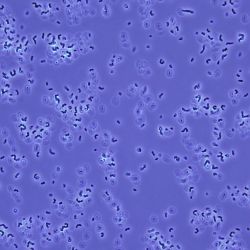 Rhodococcus erytropolis 1C Rhodococcus erytropolis 1C
