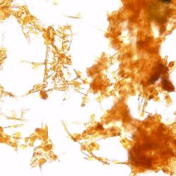 Gallionella ferruginea, Leptothrix ochracea Gallionella ferruginea, Leptothrix ochracea