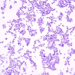 Rhodococcus pyridinovorans Rhodococcus pyridinovorans