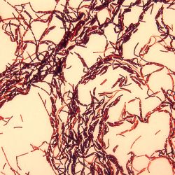 Bacillus simplex B29 Bacillus simplex B29